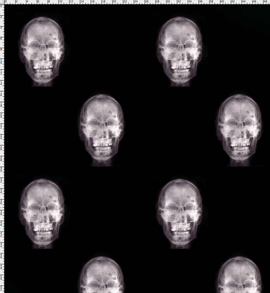 Xanadu Xray Skulls - Real Xray - Strong Xray Pattern - Pattern D