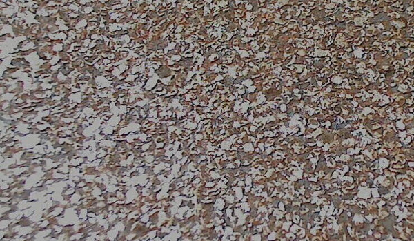 Mica Madness Real Cork Chip s | Phillipe Romano